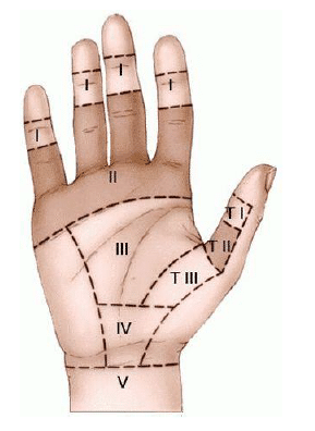 Soorten flexorpeesletsel